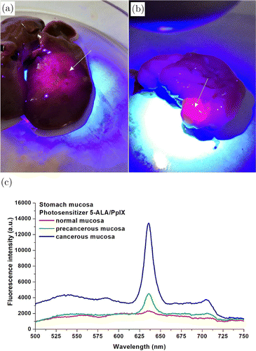 Photodynamic Diagnostics Of Early Gastric Cancer Complexity Measures Of Gastric Microcirculation And New Model Of Metastatic Adenocarcinoma Of Rat Stomach Journal Of Innovative Optical Health Sciences