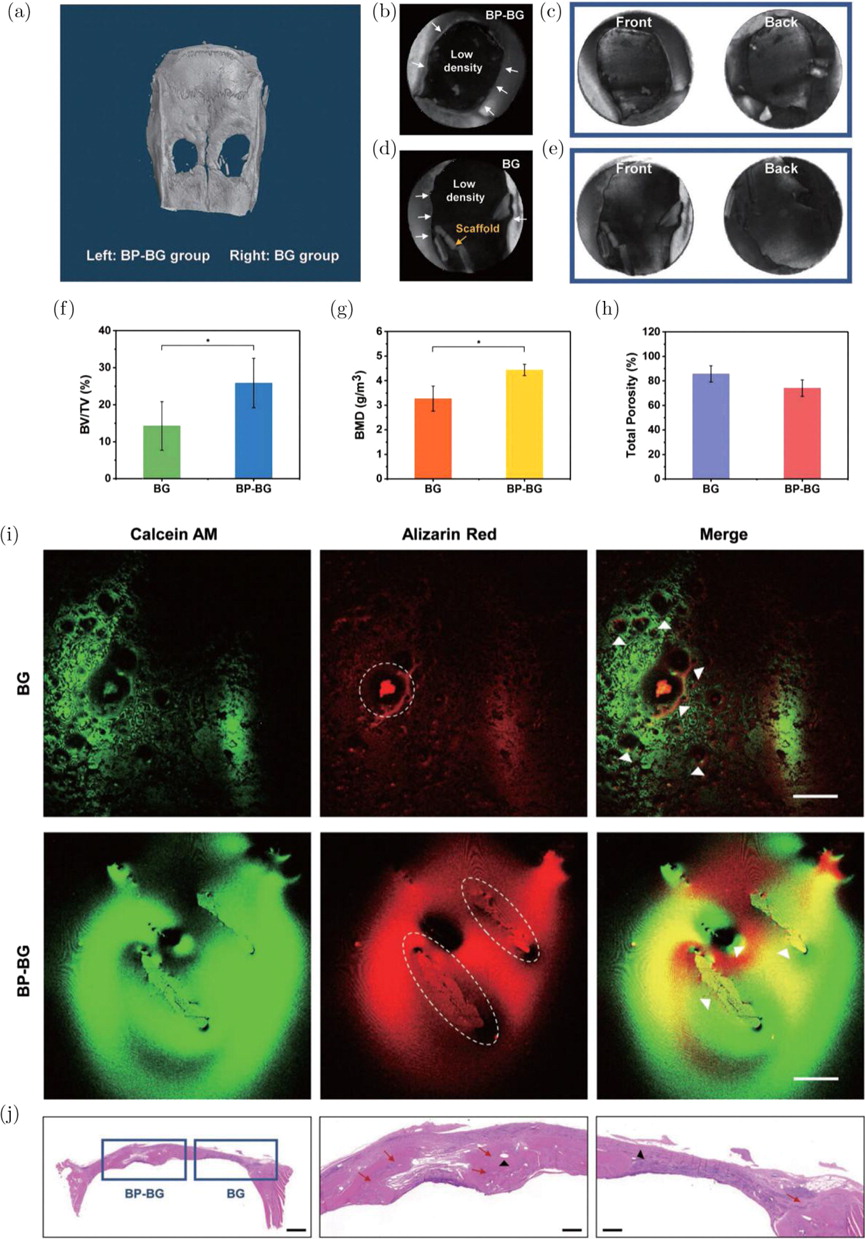 Black Phosphorus As A Versatile Nanoplatform: From Unique Properties To ...