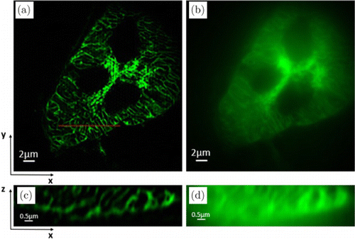 Structured Illumination Microscopy Based On Asymmetric Three-beam ...